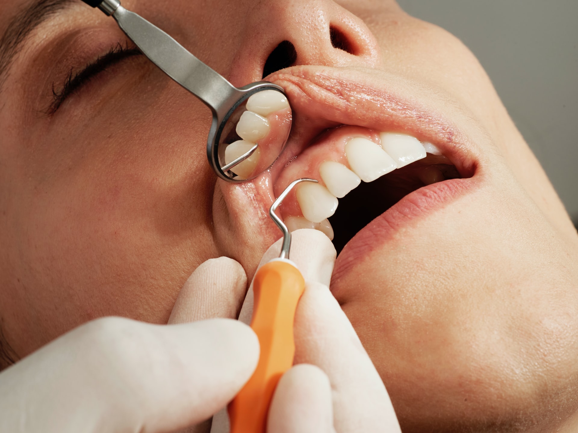 How to choose a dental center